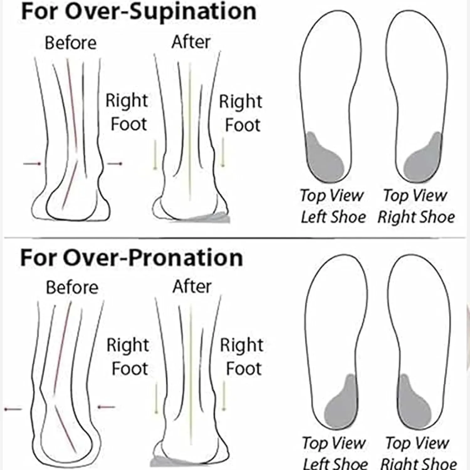 Enjerr Orthopedic Shoes Womens, Womens Orthopedic Shoes, Arch Support, Wide Slip On Soft Sole Mesh Comfortable Flat Sneakers